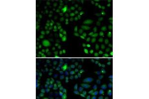 Immunofluorescence analysis of U2OS cells using EPC1 Polyclonal Antibody