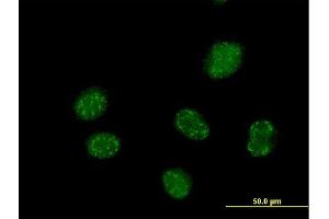 Immunofluorescence of purified MaxPab antibody to ELAC1 on HeLa cell. (ELAC1 antibody  (AA 1-363))