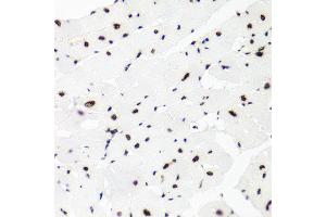 Immunohistochemistry of paraffin-embedded rat heart using H2AFX antibody at dilution of 1:100 (x40 lens). (H2AFX antibody)
