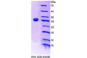 SDS-PAGE (SDS) image for Glypican 5 (GPC5) (AA 27-241) protein (His tag) (ABIN4989999) (GPC5 Protein (AA 27-241) (His tag))