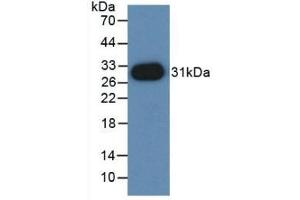 Detection of Recombinant PVRL2, Mouse using Polyclonal Antibody to Nectin 2 (NECTIN2) (PVRL2 antibody  (AA 83-291))