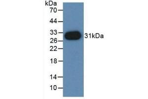 Detection of Recombinant PVRL2, Mouse using Polyclonal Antibody to Nectin 2 (NECTIN2) (PVRL2 antibody  (AA 83-291))