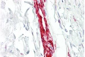 Anti-MEF2A antibody IHC staining of human nerve. (MEF2A antibody  (AA 374-423))