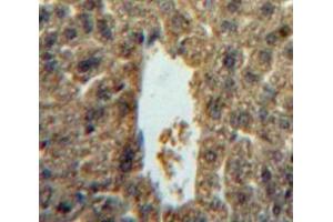 Used in DAB staining on fromalin fixed paraffin- embedded liver tissue (IL-5 antibody  (AA 20-134))