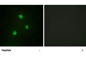 Immunofluorescence analysis of A-549 cells, using TBX1 polyclonal antibody . (T-Box 1 antibody  (C-Term))