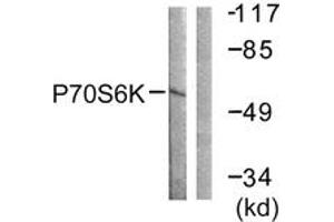 Western blot analysis of extracts from Jurkat cells, using p70 S6 Kinase (Ab-229) Antibody. (RPS6KB1 antibody  (AA 195-244))