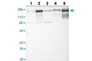 Western blot analysis of Lane 1: RT-4 cell line, Lane 2: U-251MG sp cell line, Lane 3: A-431 cell line, Lane 4: human liver tissue, and Lane 5: human tonsil tissue with LAMC1 polyclonal antibody . (Laminin gamma 1 antibody  (AA 1442-1552))