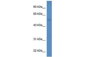 WB Suggested Anti-CYP2A6 Antibody Titration: 0. (CYP2A6 antibody  (C-Term))