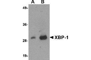 Western Blotting (WB) image for anti-X-Box Binding Protein 1 (XBP1) (AA 2-160) antibody (ABIN492538) (XBP1 antibody  (AA 2-160))