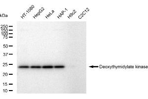 Western blotting analysis using Deoxythymidylate kinase antibody (ABIN7798311).