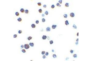 Immunohistochemistry (IHC) image for anti-BCL2-Antagonist/killer 1 (BAK1) (N-Term) antibody (ABIN2477580) (BAK1 antibody  (N-Term))