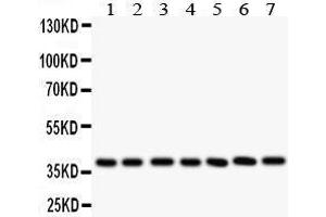 Anti-LIF antibody, Western blotting All lanes: Anti LIF  at 0. (LIF antibody  (C-Term))