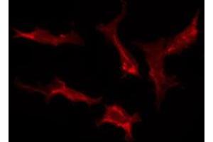 ABIN6278600 staining HepG2 by IF/ICC. (OR10K1/K2 antibody)