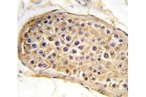 IHC analysis of FFPE human testis tissue stained with RICTOR antibody (RICTOR antibody  (AA 236-267))