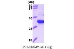 Figure annotation denotes ug of protein loaded and % gel used. (HMOX2 Protein (AA 1-264))