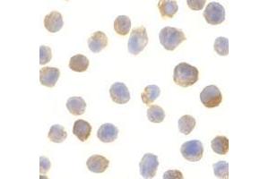 Immunocytochemistry of CTRP2 in Jurkat cells with AP30250PU-N CTRP2 antibody at 10 μg/ml. (C1QTNF2 antibody)