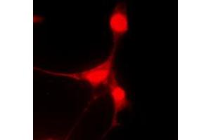 Immunofluorescent analysis of Caspase 9 staining in HeLa cells. (Caspase 9 antibody  (Center))