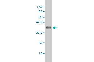 Western Blot detection against Immunogen (36. (CSNK1G1 antibody  (AA 293-393))