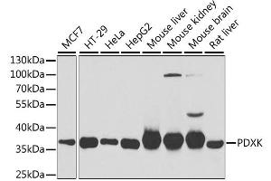 Western blot analysis of extracts of various cell lines, using PDXK antibody (ABIN2564460) at 1:1000 dilution. (PDXK antibody)
