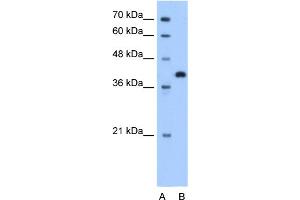 WB Suggested Anti-TOR2A Antibody Titration:  1. (TOR2A antibody  (N-Term))