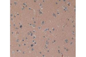 Immunohistochemistry (IHC) image for anti-Calcium Activated Nucleotidase 1 (CANT1) (AA 107-400) antibody (ABIN5013273)