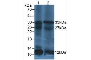 Western Blot; Sample: Lane1: Human leukocyte Cells; Lane2: Human Lymphocytes Cells. (IL12A antibody  (AA 23-219))