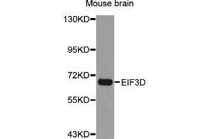 Western blot analysis of extracts of mouse brain, using EIF3D antibody (ABIN5973542).