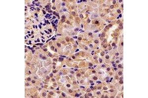 Immunohistochemical analysis of Pancreatic Lipase staining in rat kidney formalin fixed paraffin embedded tissue section. (PNLIP antibody)