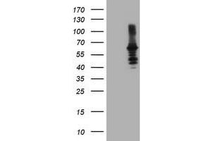 HEK293T cells were transfected with the pCMV6-ENTRY control (Left lane) or pCMV6-ENTRY DTNB (Right lane) cDNA for 48 hrs and lysed. (Dystrobrevin beta antibody)