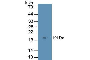 Detection of Recombinant MOG, Human using Monoclonal Antibody to Myelin Oligodendrocyte Glycoprotein (MOG) (MOG antibody  (AA 30-149))