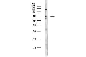 anti-FEZ Family Zinc Finger 2 (FEZF2) antibody