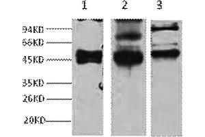 Western blot analysis of 1) Hela, 2) MCF7, 3) 293T, diluted at 1:2000. (KRT17 antibody)