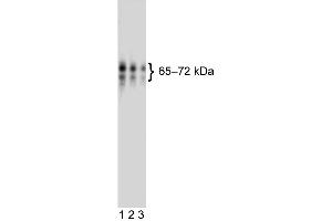 Western blot analysis of human CD110 (Thrombopoietin receptor) expressed by human HEL92.