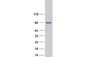Western Blotting (WB) image for BTB (POZ) Domain Containing 9 (BTBD9) (Transcript Variant 3) protein (Myc-DYKDDDDK Tag) (ABIN2715346)