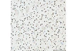 IHC analysis of SFPQ using anti-SFPQ antibody (ABIN7603089).