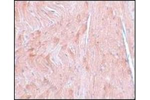 Immunohistochemistry of REEP3 in mouse heart tissue with this product at 5 μg/ml. (REEP3 antibody  (C-Term))