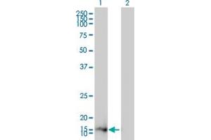 anti-Zinc Finger, Matrin-Type 4 (ZMAT4) (AA 1-153) antibody
