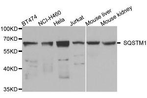 Western blot analysis of extracts of various cell lines, using SQSTM1 antibody. (SQSTM1 antibody)