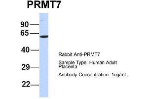 Host:  Rabbit  Target Name:  PRMT7  Sample Type:  Human Adult Placenta  Antibody Dilution:  1. (PRMT7 antibody  (N-Term))