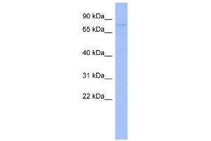 WB Suggested Anti-ZNF219 Antibody Titration:  0. (ZNF219 antibody  (Middle Region))