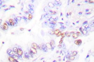 Image no. 1 for anti-X-Ray Repair Complementing Defective Repair in Chinese Hamster Cells 3 (XRCC3) antibody (ABIN271981) (XRCC3 antibody)