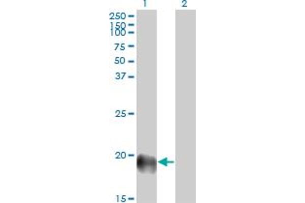 ESM1 antibody  (AA 85-184)