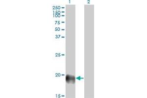 Western Blot analysis of ESM1 expression in transfected 293T cell line by ESM1 monoclonal antibody (M02), clone 6D4.