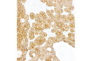 Immunohistochemistry (IHC) image for anti-Keratin 5 (KRT5) (C-Term) antibody (ABIN7795755)