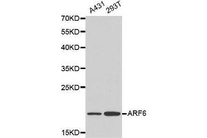 Western blot analysis of A431 cell and 293T cell lysate using ARF6 antibody. (ARF6 antibody  (AA 1-175))