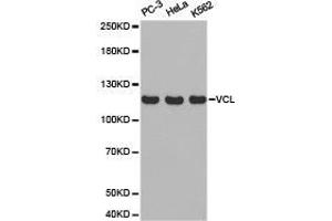 Western Blotting (WB) image for anti-Vinculin (VCL) antibody (ABIN1875315) (Vinculin antibody)