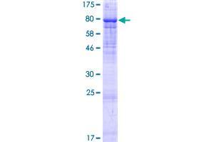 PIP5K1B Protein (AA 1-549) (GST tag)