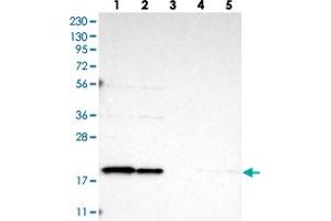 Western blot analysis of Lane 1: RT-4, Lane 2: U-251 MG, Lane 3: Human Plasma, Lane 4: Liver, Lane 5: Tonsil with TIMM17B polyclonal antibody .