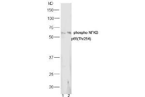 Lane 1: Mouse lung lysates Lane 2: Mouse spleen lysates probed with Rabbit Anti-NFkB p65 (Thr254) Polyclonal Antibody, Unconjugated (ABIN712886) at 1:300 overnight at 4˚C. (NF-kB p65 antibody  (pThr254))