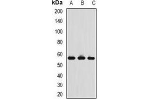 Western blot analysis of TCP1-delta expression in MCF7 (A), THP1 (B), mouse spleen (C) whole cell lysates.